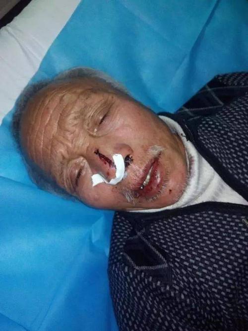 新澳门全年免费料新澳和被狗主人殴打致骨折与狗被打骨折了怎么办