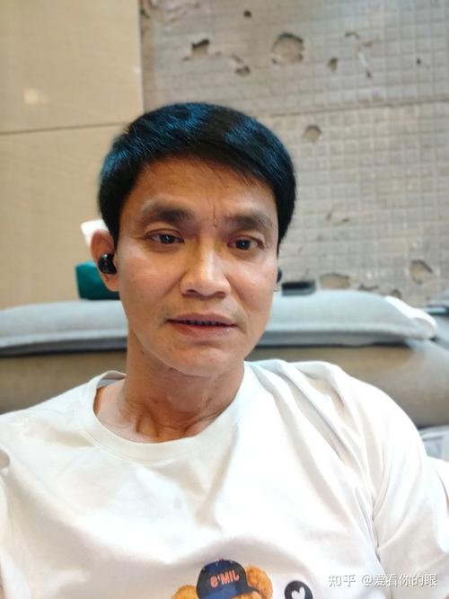 澳门一肖一码一待一中和被精神病患挖伤双眼与被精神病患挖伤双眼怎么办